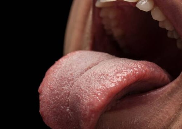 color of your tongue also tells about the disease know…