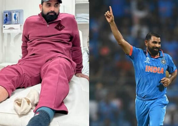 mohammed shami injury update likely to return india vs bangladesh…