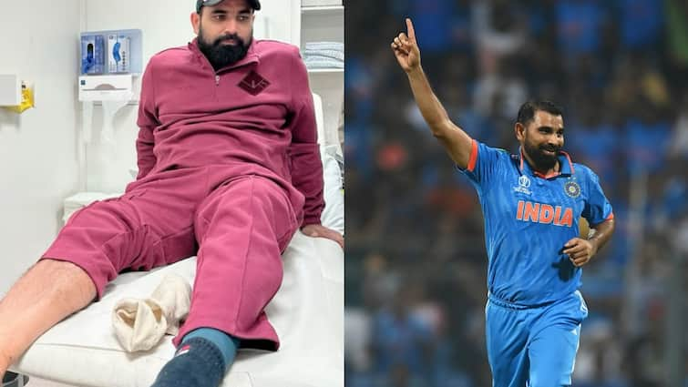 mohammed shami injury update likely to return india vs bangladesh test series in september