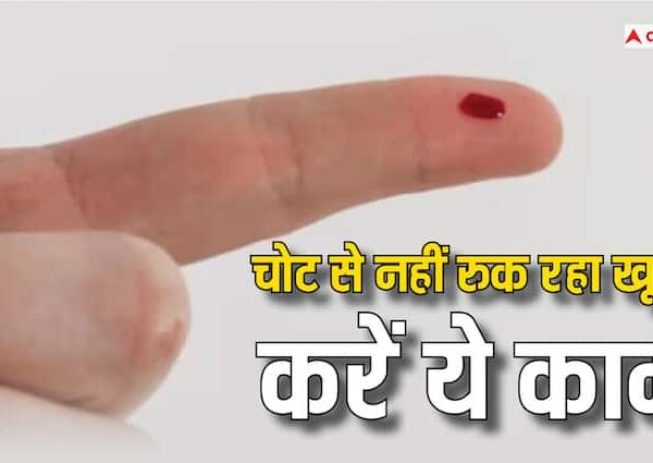 Health tips how to stop bleeding of any injury do…