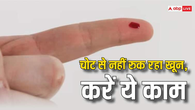 Health tips how to stop bleeding of any injury do this five effective home remedies