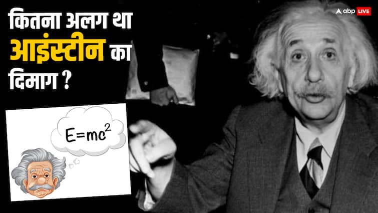 आम इंसान की तुलना में कैसे अलग था आइंस्टीन का दिमाग? रिसर्च में क्या आया था सामने