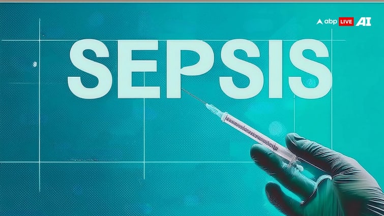 Sepsis is a life threatening condition that occurs when the body immune system